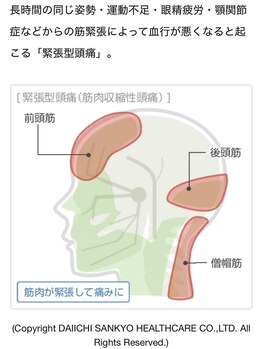 整体オガサワラ/ストレスが引き金となることも