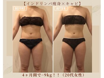 オキシー グレイス 黒崎店(OXY Grace)/インドリンパ痩身×キャビ