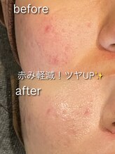 リイル バイ クレビア(REILE by Crebia)/お客様写真