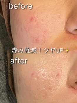 リイル バイ クレビア(REILE by Crebia)/お客様写真