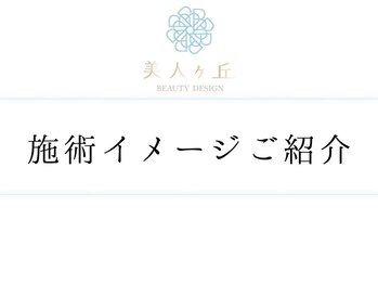 美人ヶ丘 長野店/小顔矯正,マッサージ,ヘッドスパ