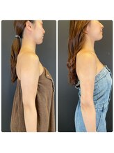 エステアンドヘアーサロン アルテ 札幌/細い二の腕応援します。