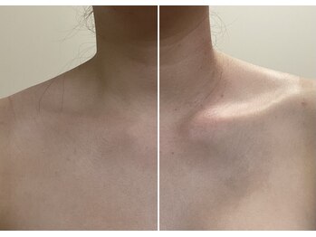 ポラリス(Polaris)/ダイエットだけじゃない!