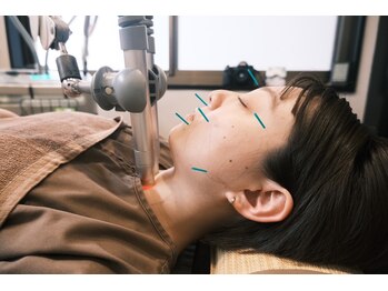 はりきゅう院 さくら/美容鍼