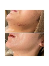 サンジュウロクドゴブ(36.5℃)/グランハーブトリートメント