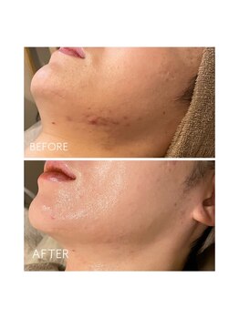 サンジュウロクドゴブ(36.5℃)/グランハーブトリートメント