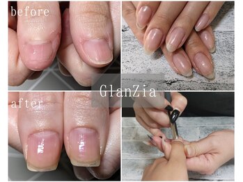 グランツィア(GlanZia)