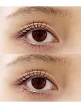 アルーマ アイ(allma.eye)/