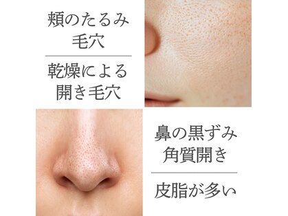 アネーロ(Anhelo)の写真