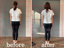 ヴレ 福岡店(Vraie)/左右差、歪み気づいていますか？