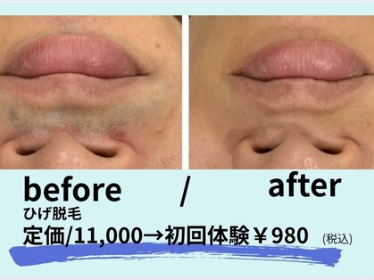 ケイ(Kei)の写真