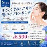 モモ(MOMO)