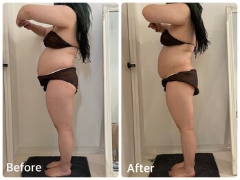 ナビ(NABI)/ぽっこりお腹撃退1回の変化