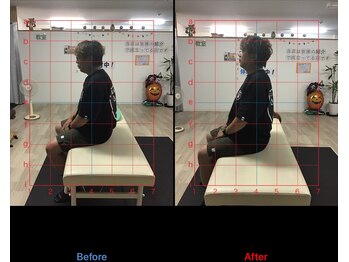 ストレチックス 近江八幡店/肩痛改善ビフォーアフター1回