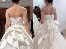 凛&美 銀座/5回施術のビフォーアフター