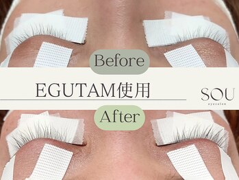 ソウ(sou.)/EGUTAM使用　前/後