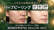 メロウスキン(MELLOW SKIN)