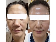 フェイシャルサロン ユキ(Yuki)の雰囲気（インセルダムお化粧品数ヶ月使用艶・法令線も薄くなって◎）