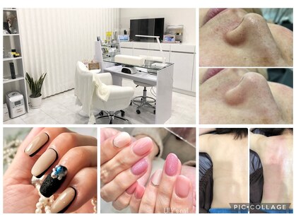 リリィズネイル(LILY's nail)の写真