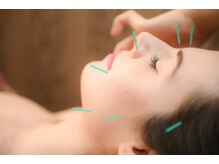 横濱 イヲリ(IORI)/美容鍼