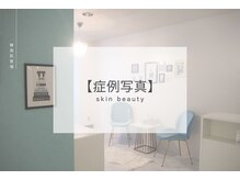 ベル 目黒(Belle)/お客様のBefore｜After