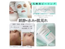リンダ(Rinda)の雰囲気（どの肌悩みの方もまず受けて頂くのが敏感肌も可【アンストレス】）