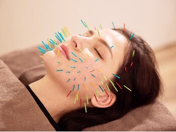 カドモリ 心斎橋(KADOMORI)の写真/【ハリネズミ美容鍼★人気No. 1/初心者から美容好きまで大満足!】