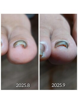 【まだまだ足りぬリフトアップ】