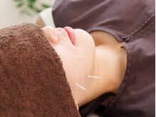 オリーブ鍼灸院