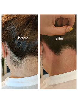 【光脱毛/WAX脱毛】doucek beauty/うなじワックス+光脱毛