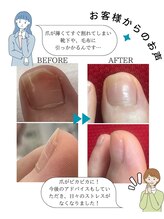 リゼラアンドコー 盛岡店/ドイツ式フットケア専門店