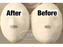 美極 銀座店/銀座/小顔コルギ/小顔矯正