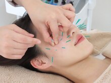 ヒトハリ 福岡薬院店(HITOHARI)/美容鍼