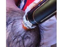 エステティック パルフェ/頭皮にインディバとエクラボーテ