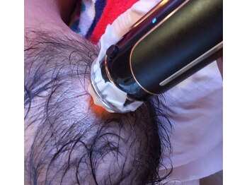 エステティック パルフェ/頭皮にインディバとエクラボーテ