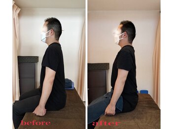 天満みぞぶち整骨院/猫背矯正