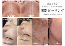 ナーズ(NAZ)