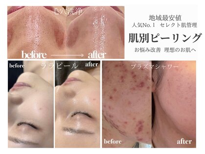 ナーズ(NAZ)の写真