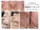 ナーズ(NAZ)の写真