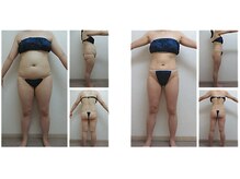 ミネルバエンダモロジー/エンダモロジー/痩身/ウェルネス