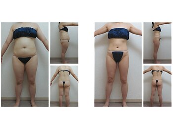 ミネルバエンダモロジー/エンダモロジー/痩身/ウェルネス