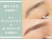 アーチ(arch)