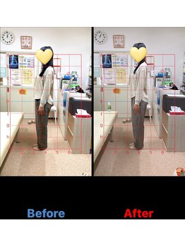 札幌整体 小林施術院/姿勢改善背筋ピーン!