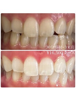 ホワイトニングルーム 横浜店(Whitening Room)/セルフホワイトニング/横浜
