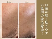 ベラノーブル(bella noble)/角質ごっそりで透明感UP!!