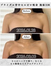 シーフェイス 横浜店(SEE FACE)/ブライダル上半身痩せ/デコルテ