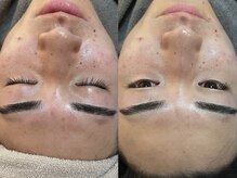 ビーマジック(Be Magic)/