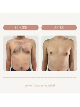 スキンマネジメント 横浜/Before &After