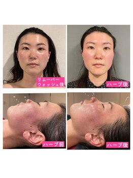 ミミルーチェ(mimiluce)/リアボーテハーブトリートメント