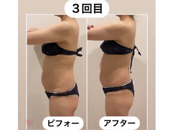 TMサロン 赤坂/首肩＆ぽっこりお腹同時ケア
